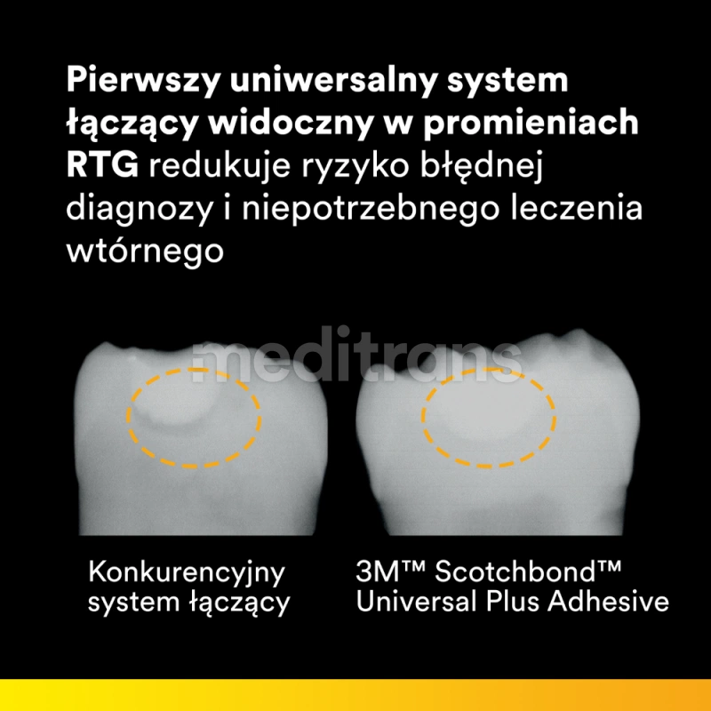 Scotchbond Universal Plus, 5 мл